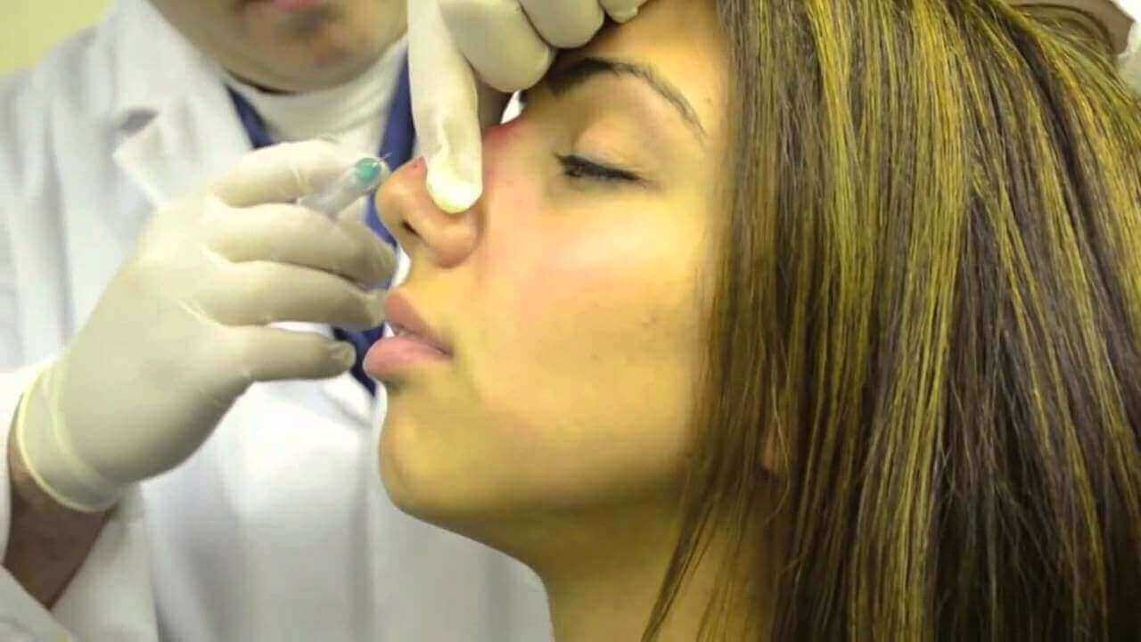 phẫu thuật thẩm mỹ mũi chuyên nghiệp