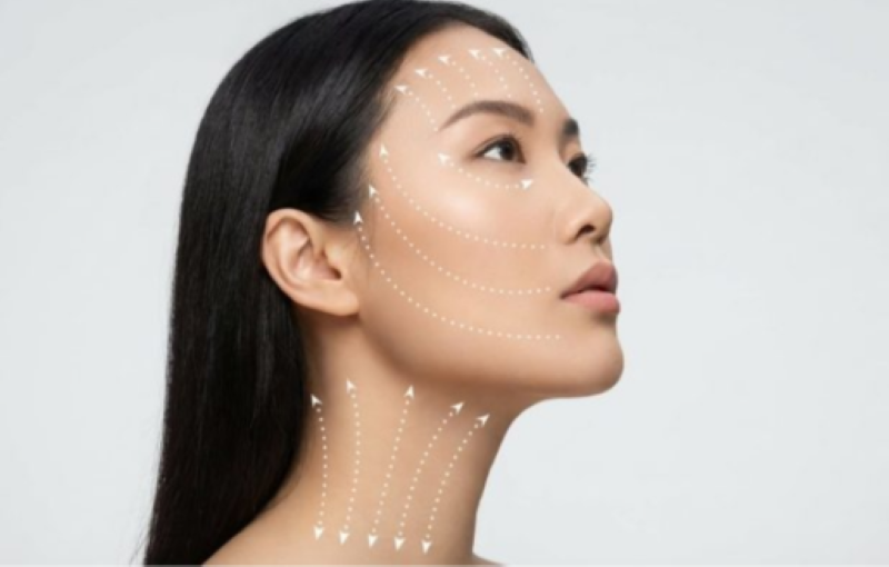 Căng da mặt bằng chỉ Collagen có biến chứng không - Thẩm mỹ Á Đông