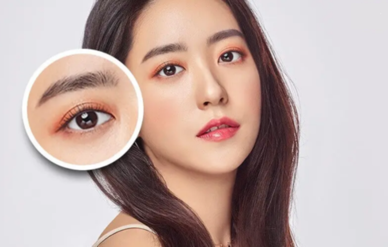 Vì sao phẫu thuật nâng mí mắt trên và dưới sẽ là những thủ thuật thẩm mỹ được ưa chuộng nhất năm 2026