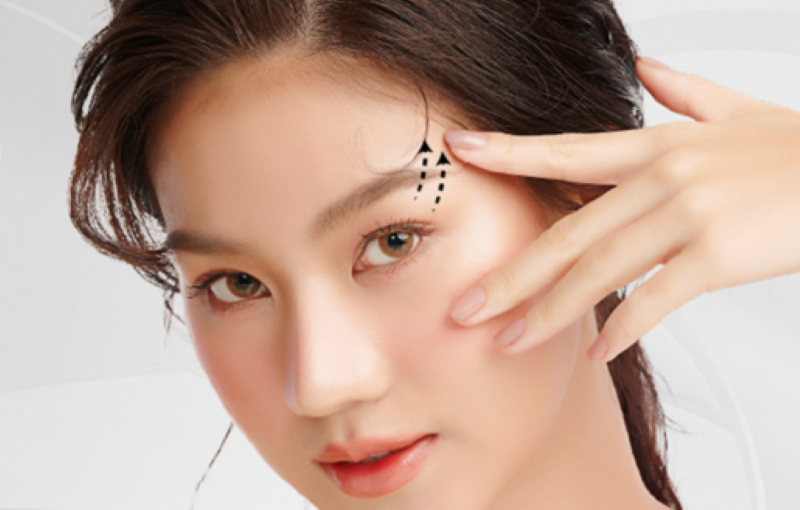 Bị sụp mí có nâng chân mày được không - TM Á Đông quận 3