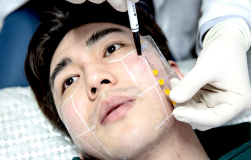 Nam giới có nên thẩm mỹ không - Thẩm mỹ Á Đông