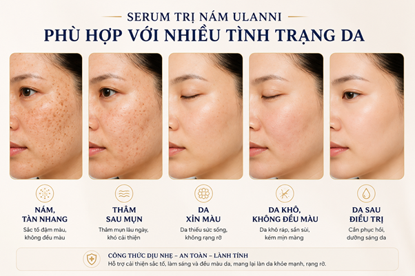 Lumination Serum Ulanni hỗ trợ chăm sóc nhiều tình trạng da