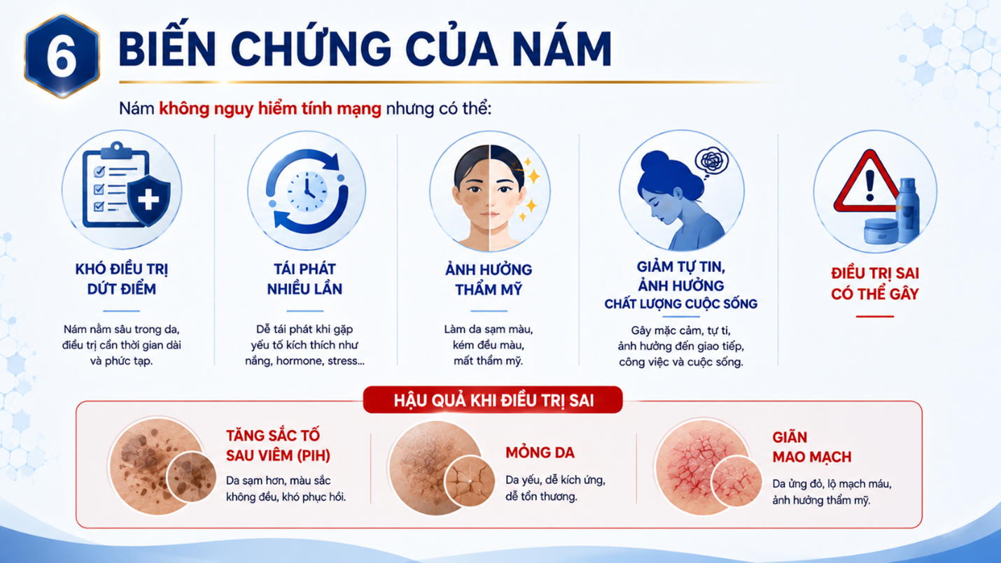 bien-chung-cua-nam-corticoid