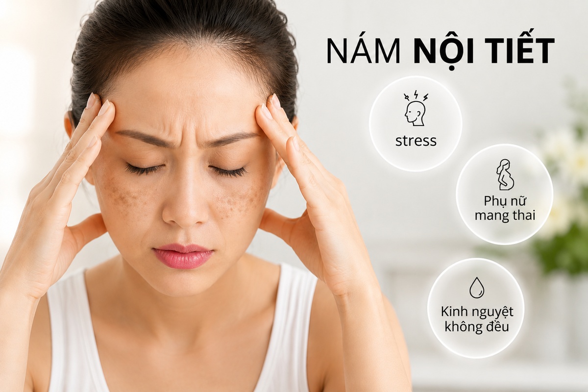nam_noi_tiet_duoi_stress