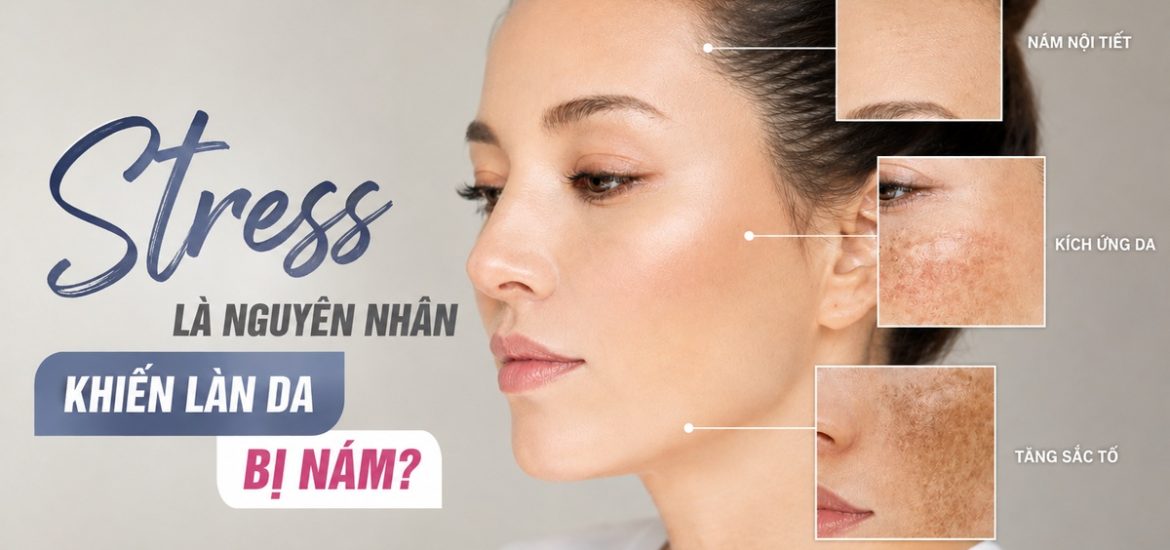 nam_noi_tiet_stressb nam_noi_tiet_stressb