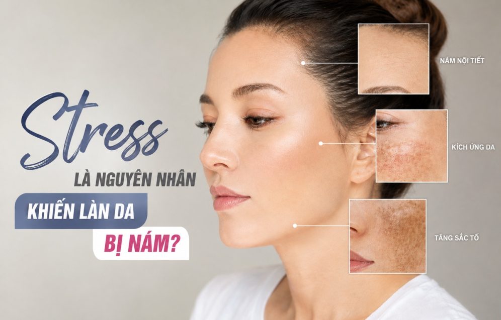 nam_noi_tiet_stressb nam_noi_tiet_stressb