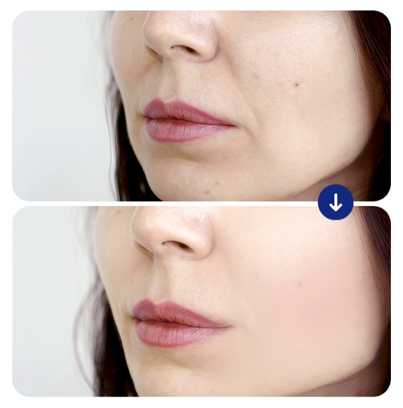 tre-hoa-da-tieu-phau-14