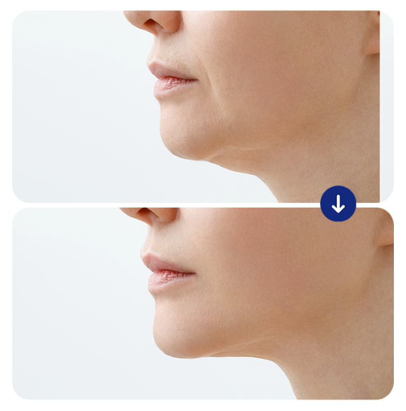 tre-hoa-da-tieu-phau-15