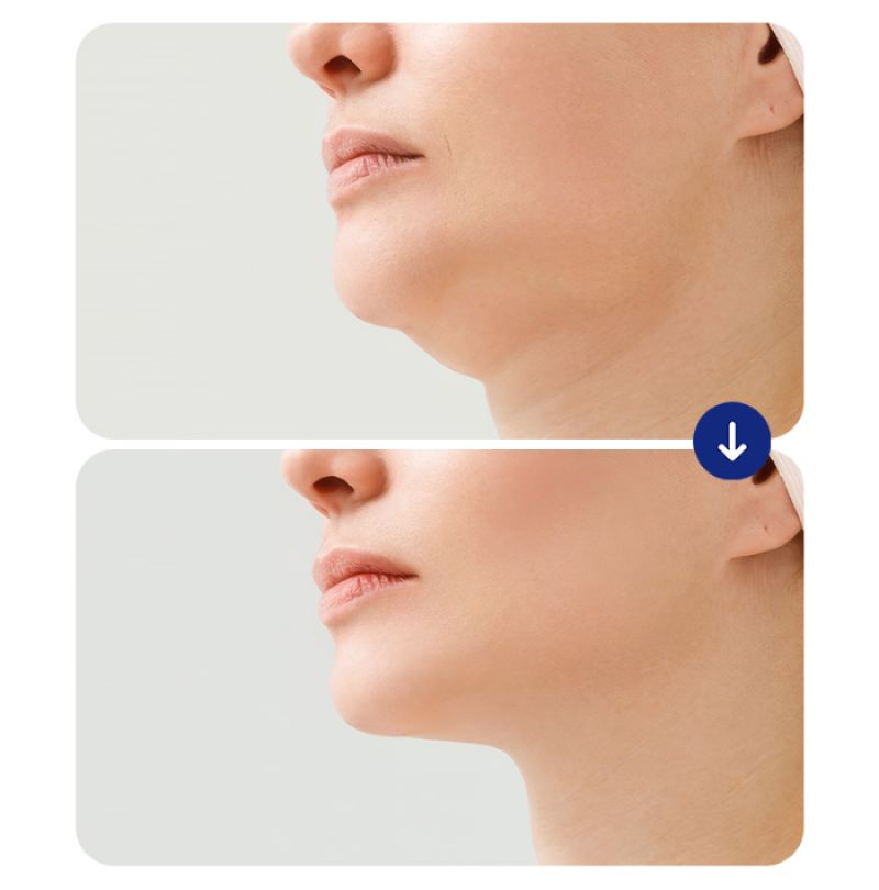 tre-hoa-da-tieu-phau-16